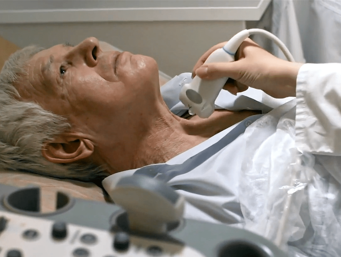 Image of an elderly man getting a carotid ultrasound.